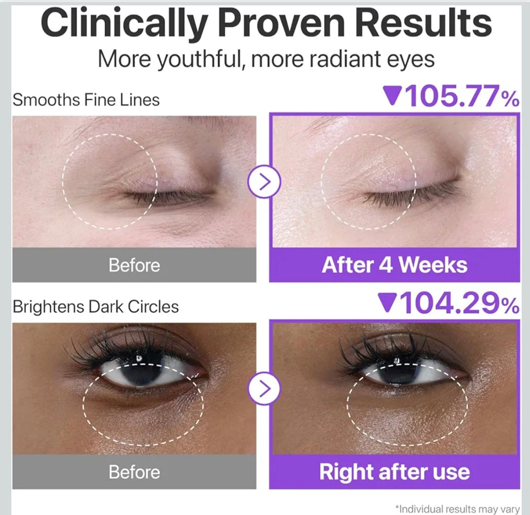 Numbuzin Crema contiene  NAD+ Retinol